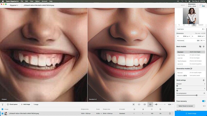 01-TEETH